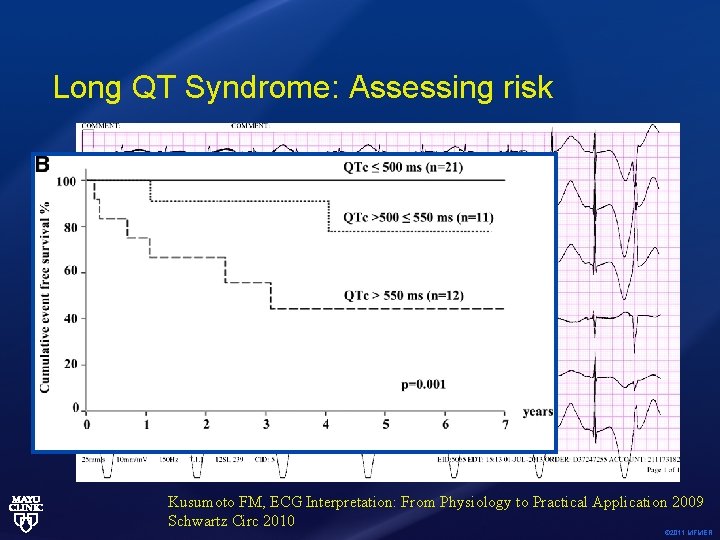 Long QT Syndrome: Assessing risk Kusumoto FM, ECG Interpretation: From Physiology to Practical Application