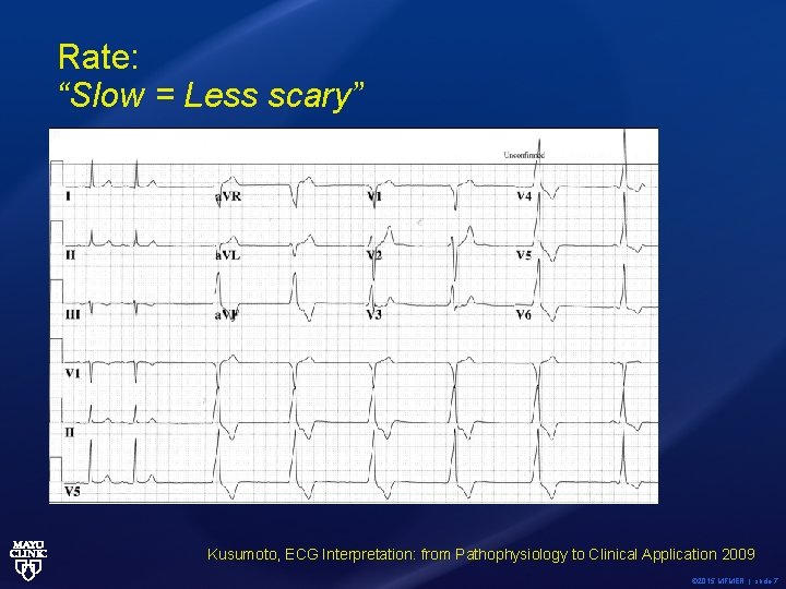 Rate: “Slow = Less scary” Kusumoto, ECG Interpretation: from Pathophysiology to Clinical Application 2009