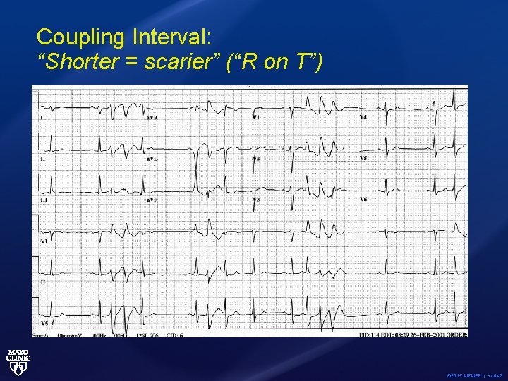 Coupling Interval: “Shorter = scarier” (“R on T”) © 2015 MFMER | slide-8 