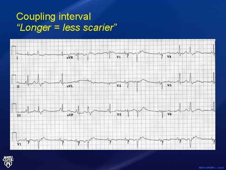 Coupling interval “Longer = less scarier” © 2015 MFMER | slide-9 