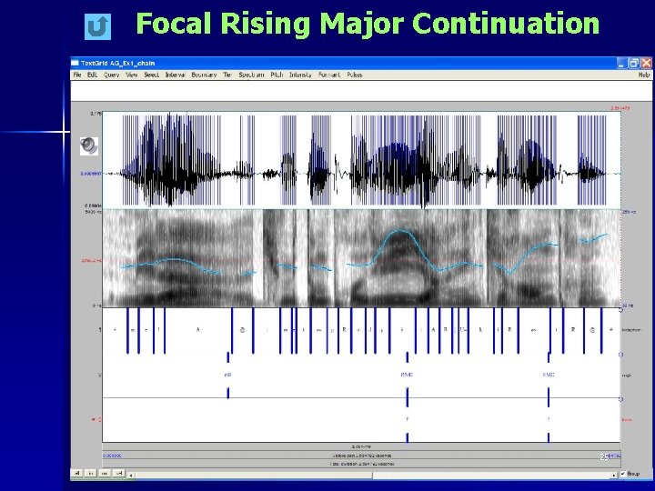 Focal Rising Major Continuation 25 