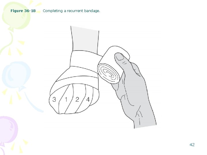 Figure 36 -18 Completing a recurrent bandage. 42 