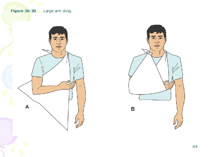 Figure 36 -20 Large arm sling. 44 