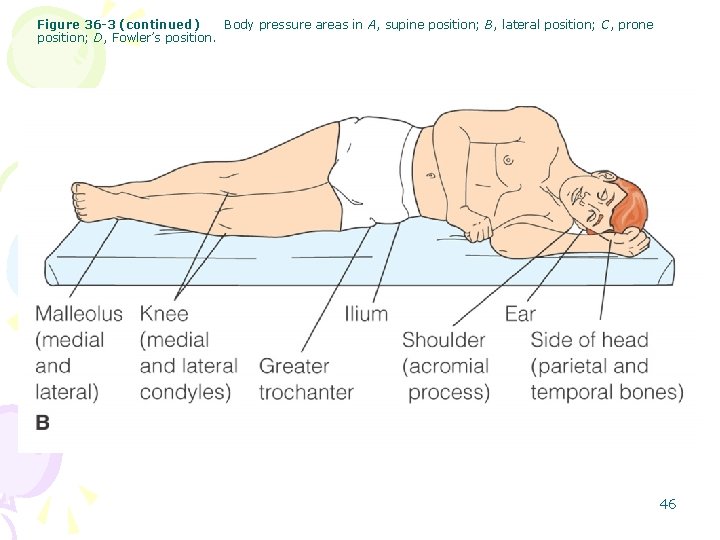 Figure 36 -3 (continued) Body pressure areas in A, supine position; B, lateral position;