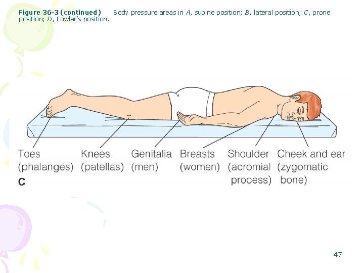 Figure 36 -3 (continued) Body pressure areas in A, supine position; B, lateral position;