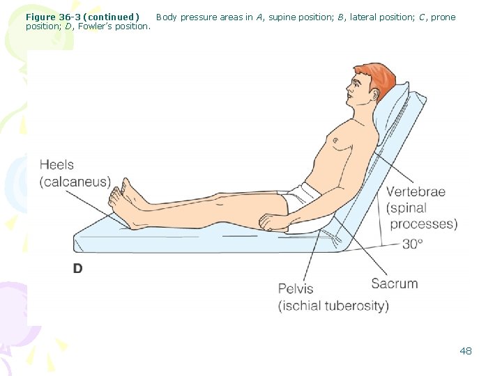 Figure 36 -3 (continued) Body pressure areas in A, supine position; B, lateral position;