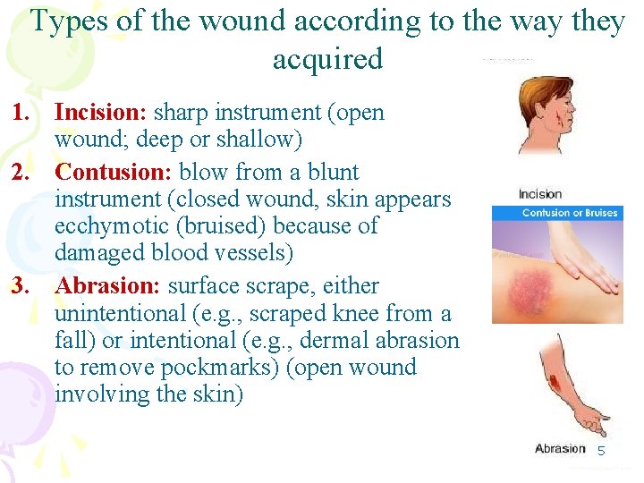 Types of the wound according to the way they acquired 1. Incision: sharp instrument