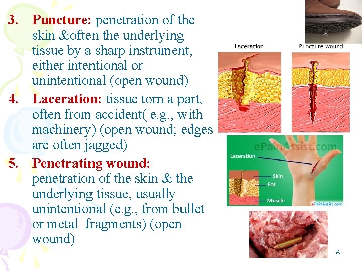 3. Puncture: penetration of the skin &often the underlying tissue by a sharp instrument,