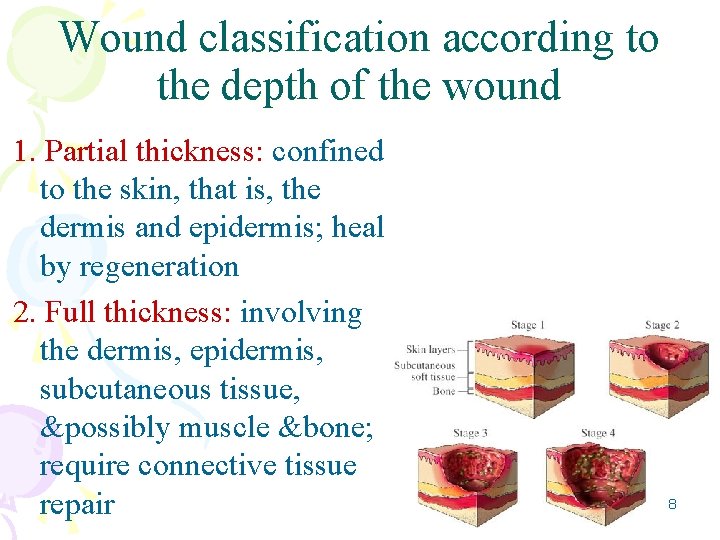 Wound classification according to the depth of the wound 1. Partial thickness: confined to