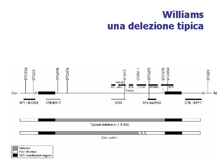 Williams una delezione tipica 