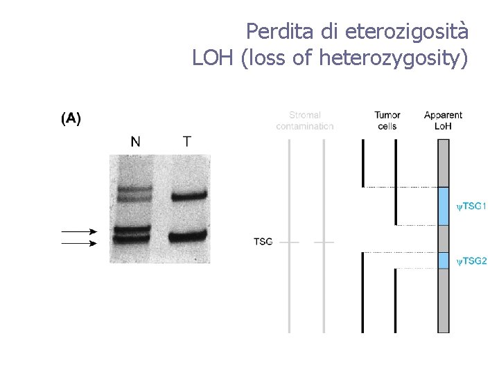 Perdita di eterozigosità LOH (loss of heterozygosity) 