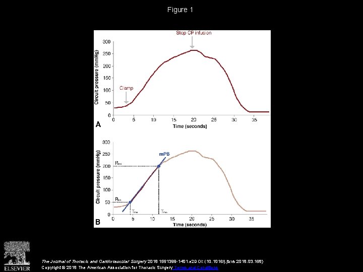 Figure 1 The Journal of Thoracic and Cardiovascular Surgery 2018 1561399 -1401. e 2