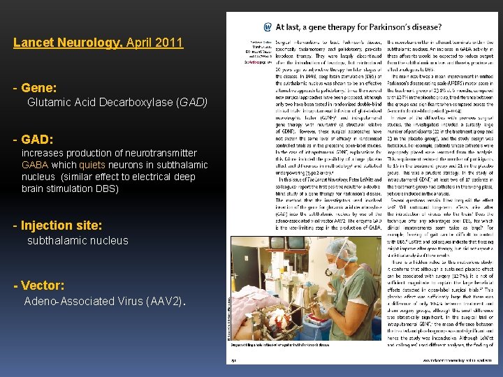 Lancet Neurology, April 2011 - Gene: Glutamic Acid Decarboxylase (GAD) - GAD: increases production