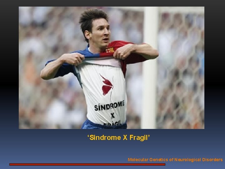 ‘Sindrome X Fragil’ Molecular Genetics of Neurological Disorders 