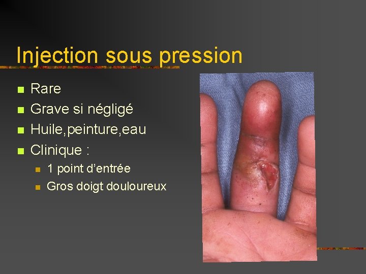 Injection sous pression n n Rare Grave si négligé Huile, peinture, eau Clinique :