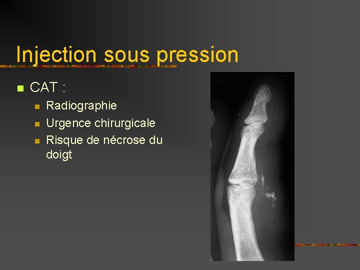 Injection sous pression n CAT : n n n Radiographie Urgence chirurgicale Risque de