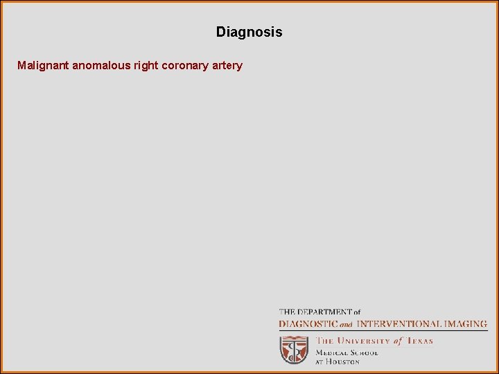 Diagnosis Malignant anomalous right coronary artery 