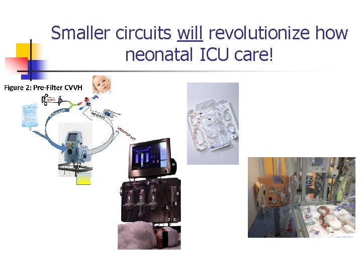 Smaller circuits will revolutionize how neonatal ICU care! 