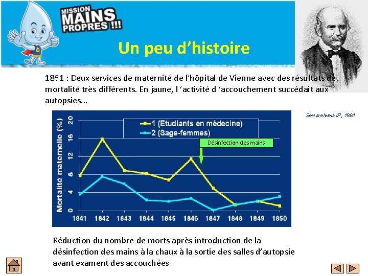 Un peu d’histoire 1861 : Deux services de maternité de l’hôpital de Vienne avec