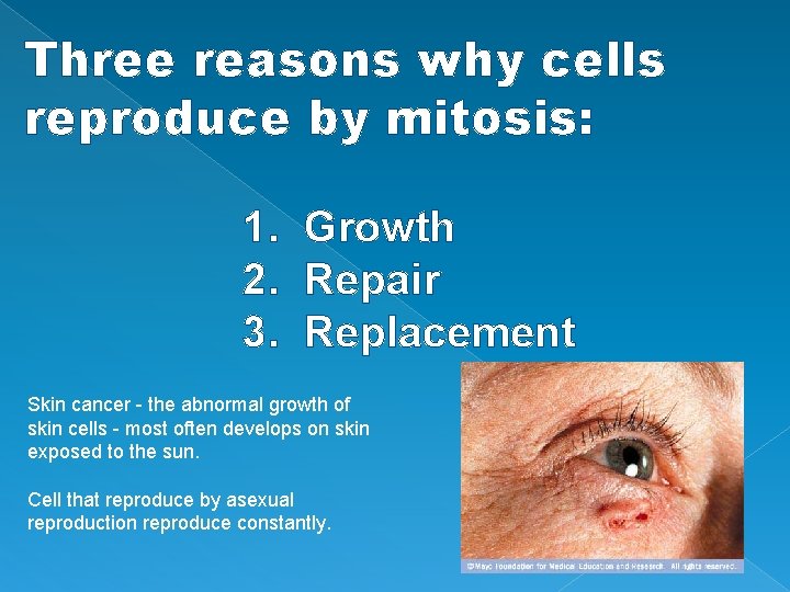 Three reasons why cells reproduce by mitosis: 1. Growth 2. Repair 3. Replacement Skin