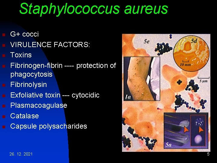 Staphylococcus aureus n n n n n G+ cocci VIRULENCE FACTORS: Toxins Fibrinogen-fibrin ----