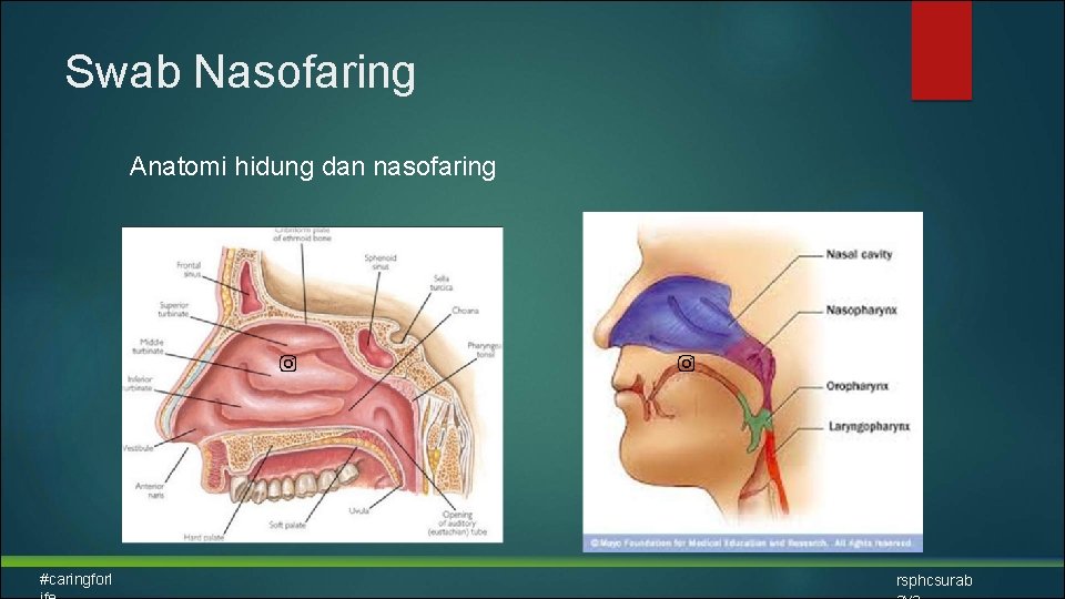 Swab Nasofaring Anatomi hidung dan nasofaring #caringforl rsphcsurab 