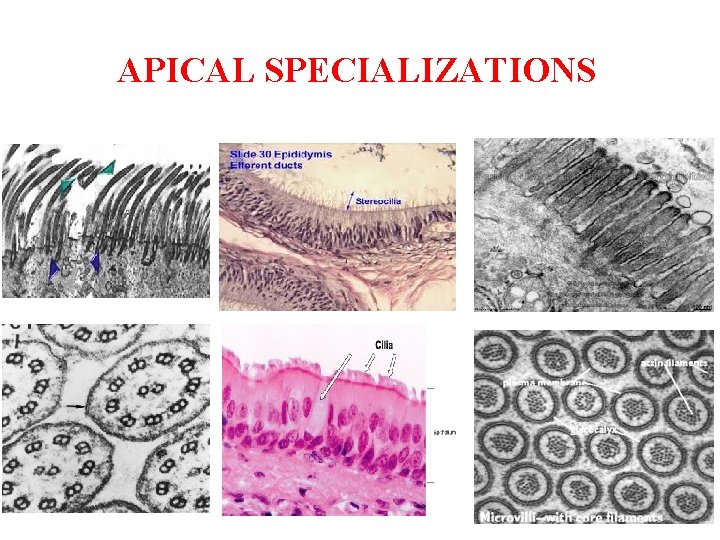 APICAL SPECIALIZATIONS 