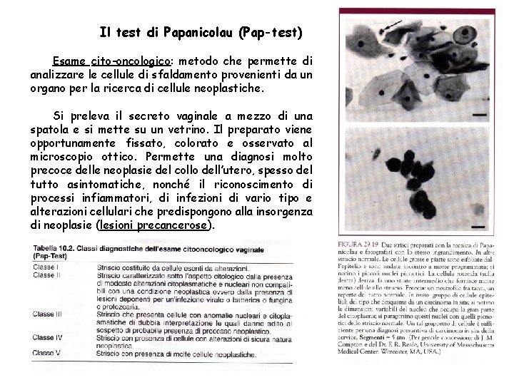 Il test di Papanicolau (Pap-test) Esame cito-oncologico: metodo che permette di analizzare le cellule