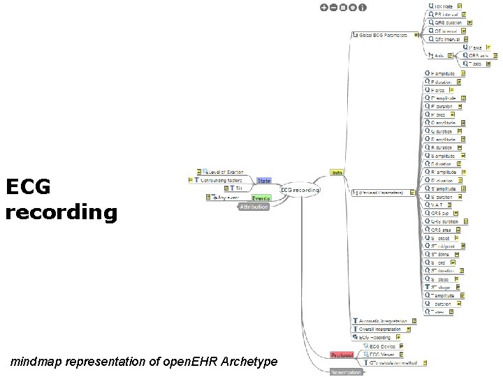 ECG recording mindmap representation of open. EHR Archetype 