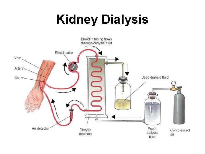 Kidney Dialysis 