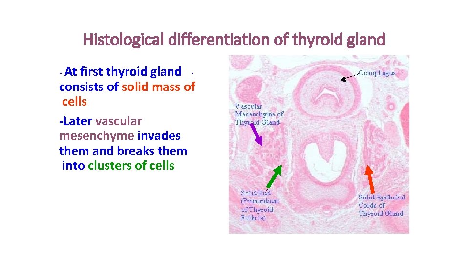 Histological differentiation of thyroid gland - At first thyroid gland consists of solid mass