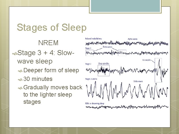 Stages of Sleep NREM Stage 3 + 4: Slowwave sleep Deeper form of sleep Stages of Sleep NREM Stage 3 + 4: Slowwave sleep Deeper form of sleep