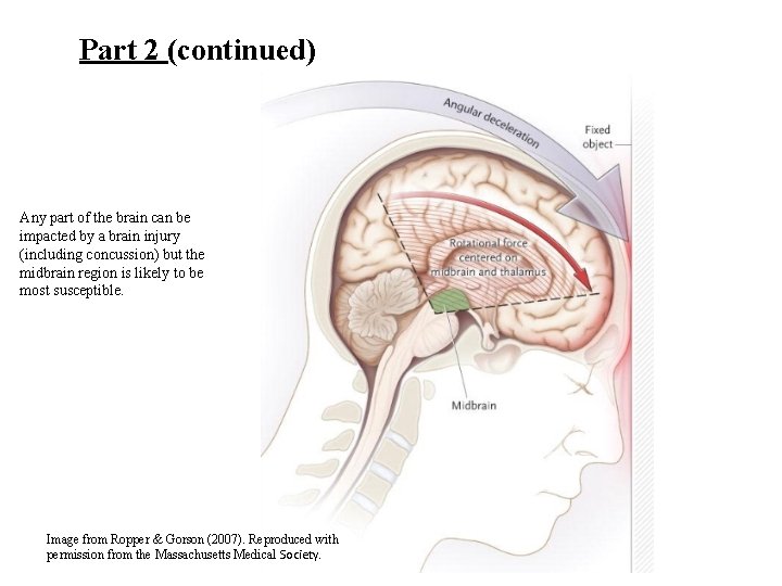 Part 2 (continued) Any part of the brain can be impacted by a brain
