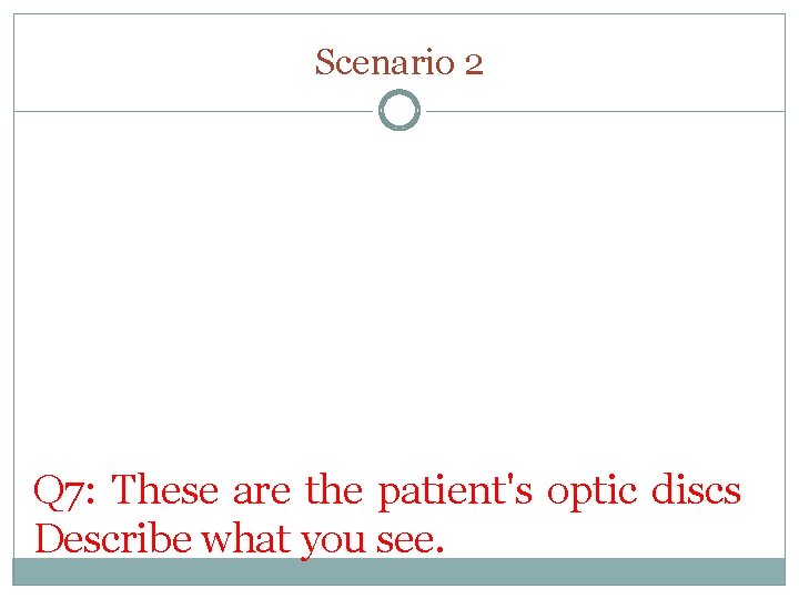 Scenario 2 Right Left Q 7: These are the patient's optic discs Describe what