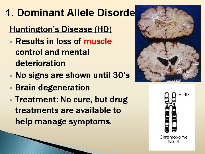 1. Dominant Allele Disorders Huntington’s Disease (HD) § Results in loss of muscle control