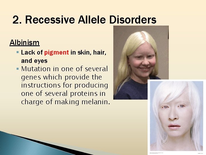 2. Recessive Allele Disorders Albinism § Lack of pigment in skin, hair, and eyes