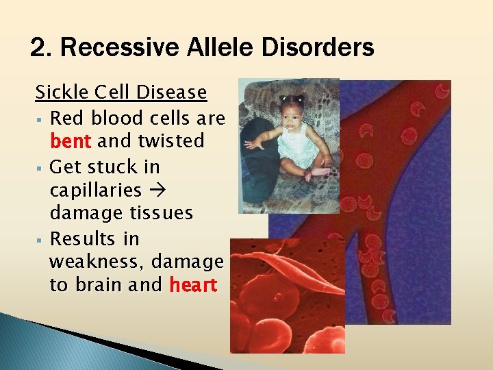 2. Recessive Allele Disorders Sickle Cell Disease § Red blood cells are bent and