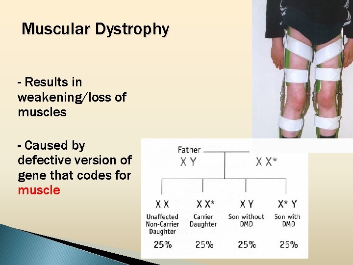 Muscular Dystrophy - Results in weakening/loss of muscles - Caused by defective version of