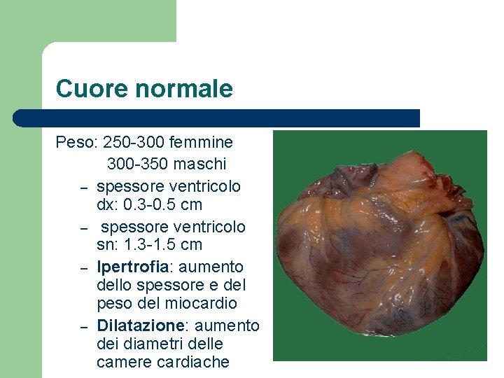 Cuore normale Peso: 250 -300 femmine 300 -350 maschi – spessore ventricolo dx: 0.