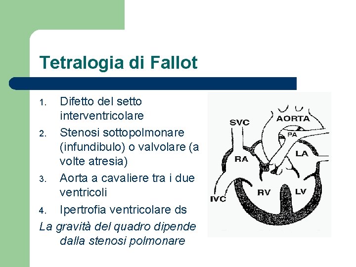 Tetralogia di Fallot Difetto del setto interventricolare 2. Stenosi sottopolmonare (infundibulo) o valvolare (a