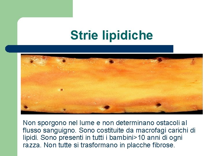 Strie lipidiche Non sporgono nel lume e non determinano ostacoli al flusso sanguigno. Sono