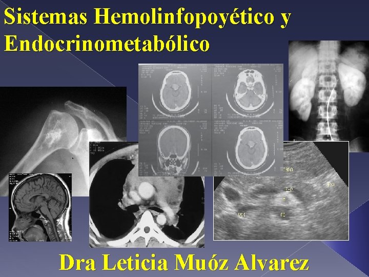 Sistemas Hemolinfopoyético y Endocrinometabólico Dra Leticia Muóz Alvarez 