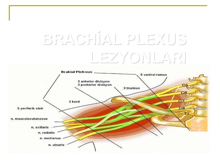 BRACHİAL PLEXUS LEZYONLARI 