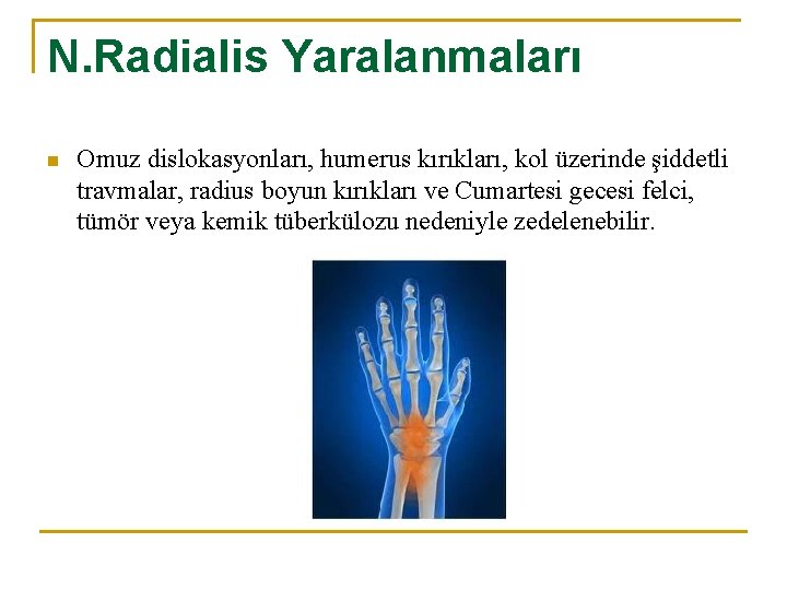 N. Radialis Yaralanmaları n Omuz dislokasyonları, humerus kırıkları, kol üzerinde şiddetli travmalar, radius boyun