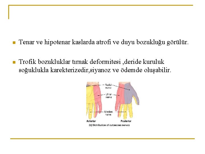 n Tenar ve hipotenar kaslarda atrofi ve duyu bozukluğu görülür. n Trofik bozukluklar tırnak