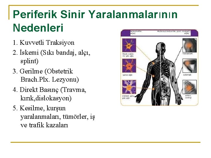 Periferik Sinir Yaralanmalarının Nedenleri 1. Kuvvetli Traksiyon 2. İskemi (Sıkı bandaj, alçı, splint) 3.