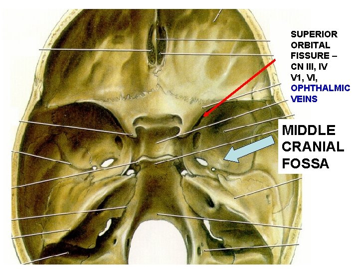 SUPERIOR ORBITAL FISSURE – CN III, IV V 1, VI, OPHTHALMIC VEINS MIDDLE CRANIAL
