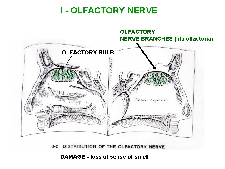 I - OLFACTORY NERVE BRANCHES (fila olfactoria) OLFACTORY BULB DAMAGE - loss of sense