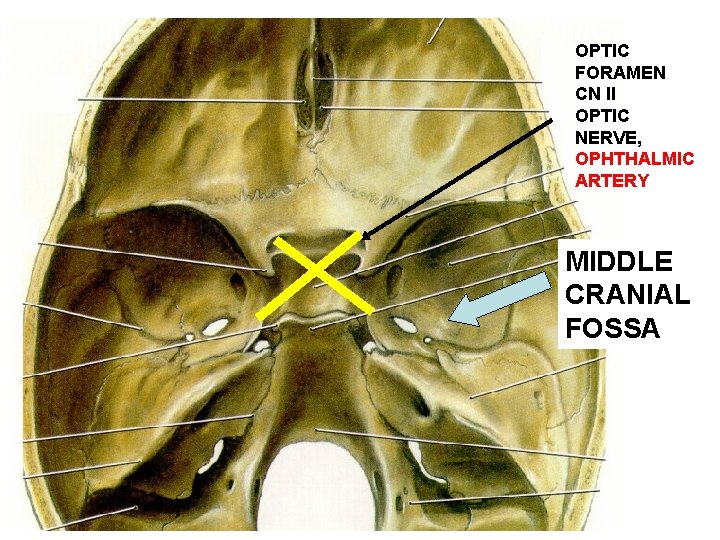 OPTIC FORAMEN CN II OPTIC NERVE, OPHTHALMIC ARTERY MIDDLE CRANIAL FOSSA 