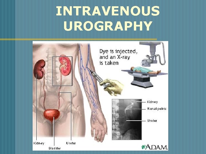 INTRAVENOUS UROGRAPHY 